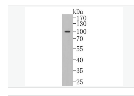 Anti-Calnexin antibody-钙连蛋白重组兔单克隆抗体