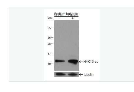 Anti-Histone H4-乙酰化组蛋白H4(K16)重组兔单克隆抗体