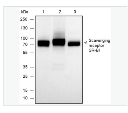 Anti-SCARB1-高密度脂蛋白受体/清道夫受体重组兔单克隆抗体