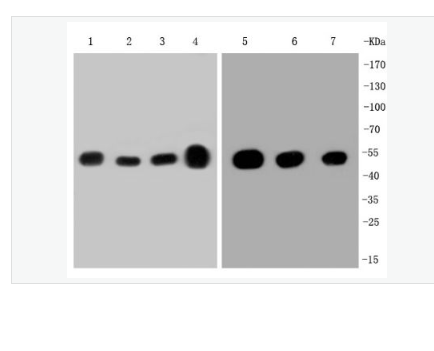 Anti-beta Tubulin  antibody-微管蛋白重组兔单克隆抗体