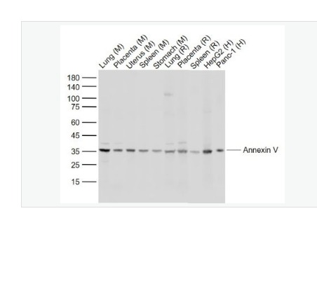 Anti-Annexin V antibody-重组膜粘连蛋白5抗体