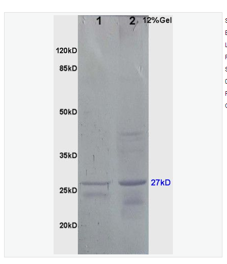 Anti-HSP27 antibody -热休克蛋白27/HSP25抗体