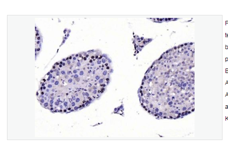 Anti-CDKN1A/p21 antibody -p21蛋白抗体