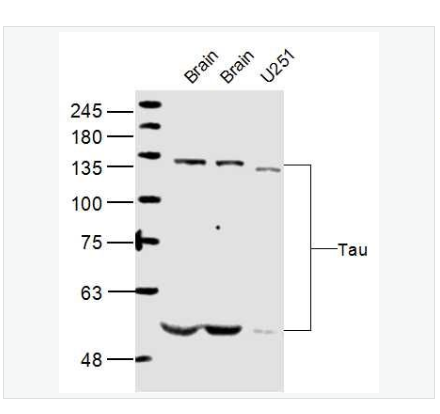 Anti-Tau antibody -微管相关蛋白抗体