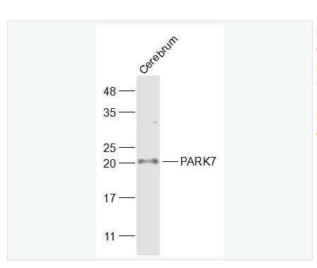 Anti-PARK7/DJ1 antibody -CAP1抗体