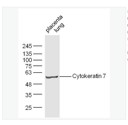 Anti-CK7 antibody-细胞角蛋白7抗体