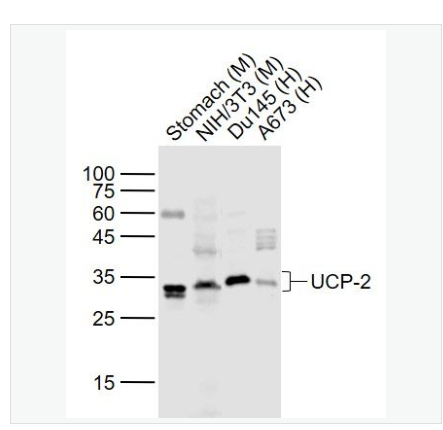 Anti-UCP-2 antibody-线粒体脱偶连蛋白2抗体