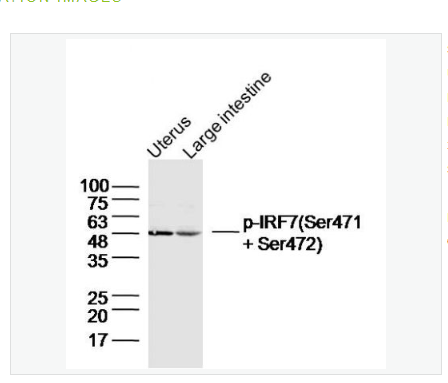 Anti-Phospho-IRF7  antibody-磷酸化干扰素调节因子7抗体