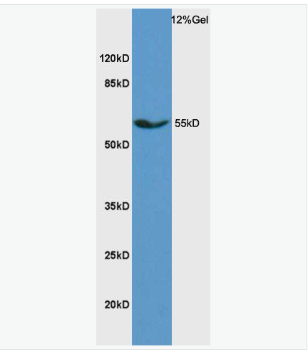 Anti-SCD antibody -固醇酰辅酶A脱氢酶1抗体