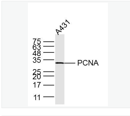 Anti-PCNA -增殖细胞核抗原（核内参）单克隆抗体