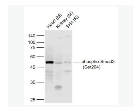 Anti-phospho-Smad3 antibody-磷酸化细胞信号转导分子SMAD3抗体