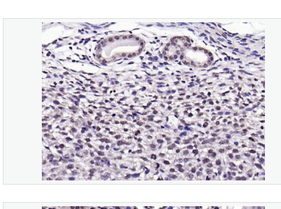 Anti-NPD014 antibody-1号染色体开放阅读框63抗体