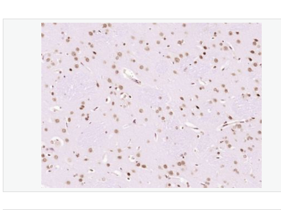 Anti-LMX1b antibody-指甲髌骨综合征相关蛋白NPS1抗体