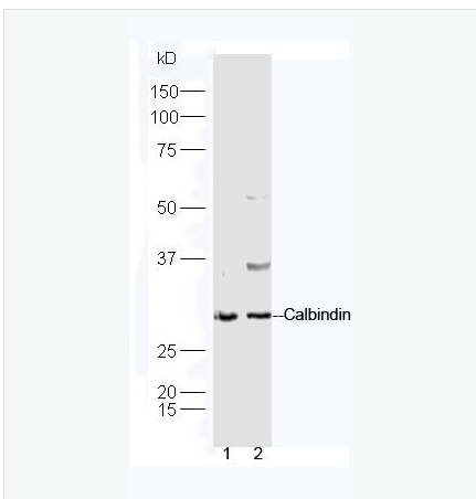 Anti-Calbindin antibody-钙结合蛋白D28K抗体