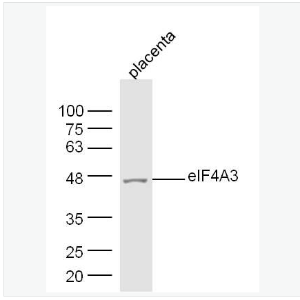 Anti-NSE antibody-神经元特异性烯醇化酶/γ 烯醇化酶抗体