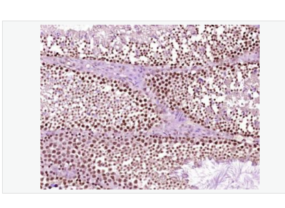 Anti-phospho-Src (Ser75) antibody-磷酸化src原癌基因抗体