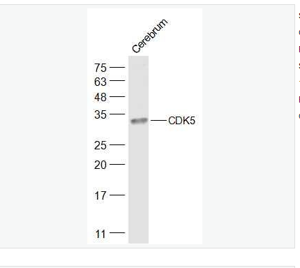 Anti-CDK5 antibody-周期素依赖性激酶5抗体