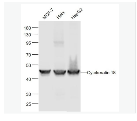 Anti-CK18 antibody-细胞角蛋白18重组兔单克隆抗体