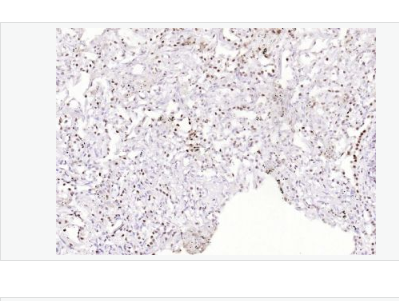 Anti-phospho-ATF2-磷酸化活化复制因子2重组兔单克隆抗体