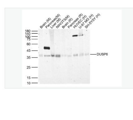 Anti-DUSP6 antibody-双特异性蛋白磷酸酶6重组兔单克隆抗体