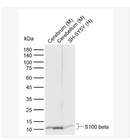 Anti-S100 beta antibody-S100B蛋白重组兔单克隆抗体