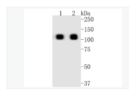 Anti-ACE2 antibody-重组兔血管紧张素转换酶单克隆抗体