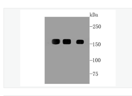 Anti-EGFR antibody-表皮生长因子受体重组兔单克隆抗体