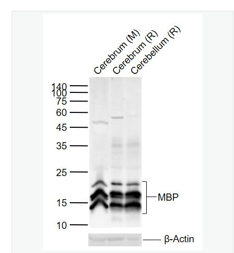 Anti-MBP antibody-髓鞘碱性蛋白/磷脂碱性蛋白抗体