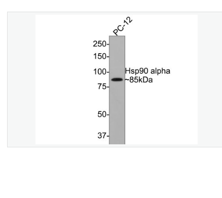 Anti-Hsp90 alpha  antibody-热休克蛋白90α重组兔单克隆抗体