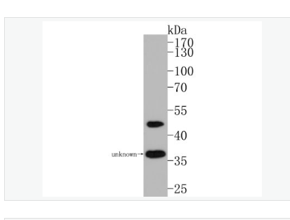 Anti-Nogo-A antibody-轴索过度生长抑制因子-A重组兔单克隆抗体