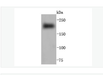 Anti-MYH6 antibody-心肌肌球蛋白重链重组兔单克隆抗体