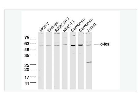 Anti-c-fos antibody-c-fos抗体