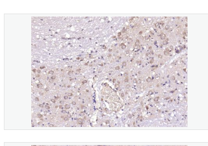 Anti-CRF antibody-促肾上皮质激素释放激素抗体