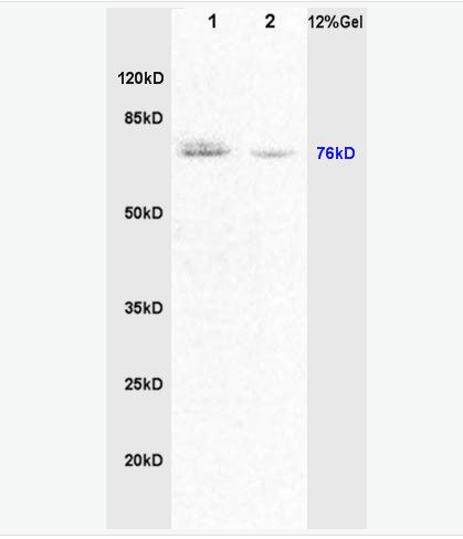 Anti-CRF antibody-蓬乱蛋白1抗体