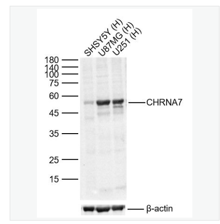 Anti-CHRNA7 antibody-烟碱型乙酰胆碱受体α7抗体