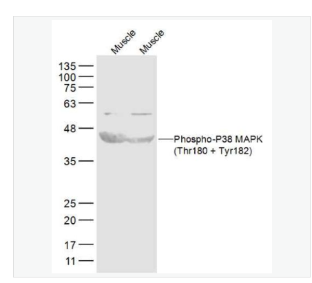 Anti-Phospho-P38 MAPK-磷酸化-丝裂原活化蛋白激酶p38抗体