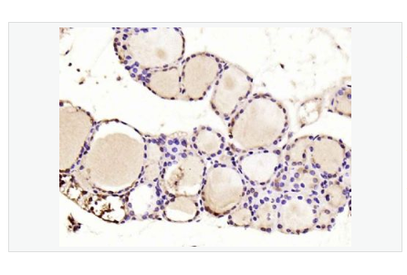 Anti-PTEN antibody -PTEN抗体