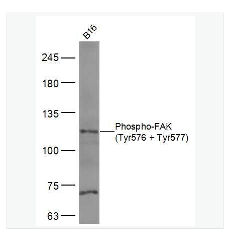 Anti-Phospho-FAK antibody -磷酸化粘着斑激酶抗体