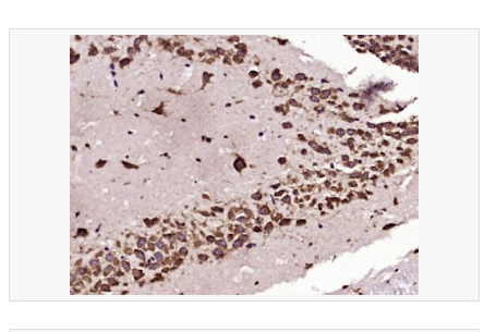 Anti-TGF beta 1 antibody -转化生长因子β1/TGF β1/TGF-β1单克隆抗体