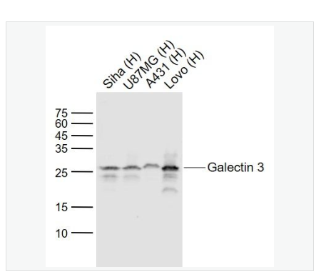 Anti-Galectin 3 antibody-半乳糖凝集素3单克隆抗体