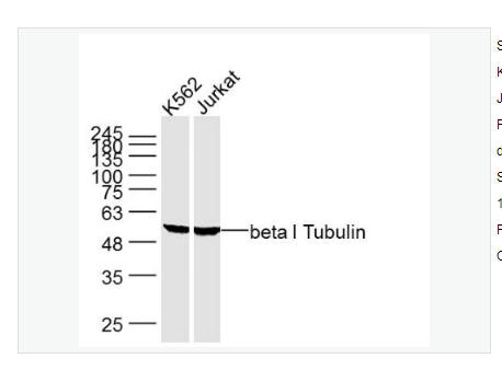 Anti-beta I Tubulin antibody-微管蛋白β1 tubulin(内参)单克隆抗体