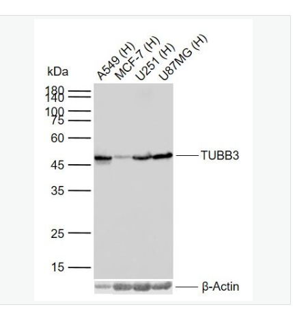 Anti-TUBB3 antibody-微管蛋白β3（神经标志物）单克隆抗体