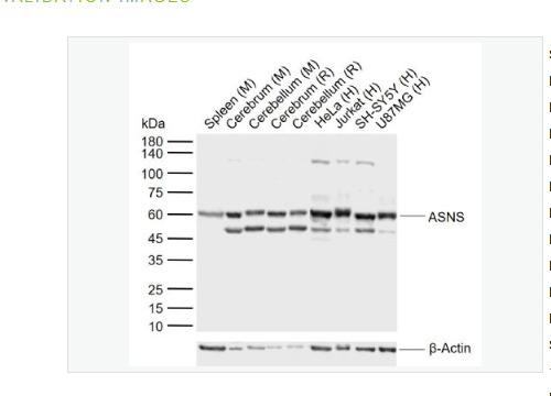 Anti-ASNS antibody -天冬酰胺合成酶