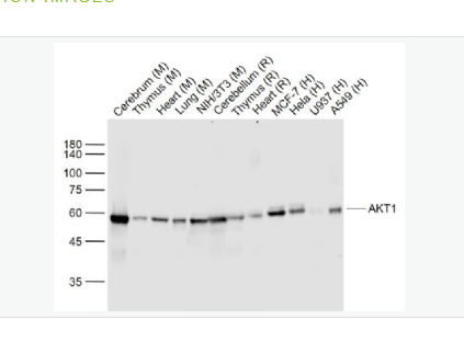 Anti-AKT1 antibody -蛋白激酶B重组兔单克隆抗体