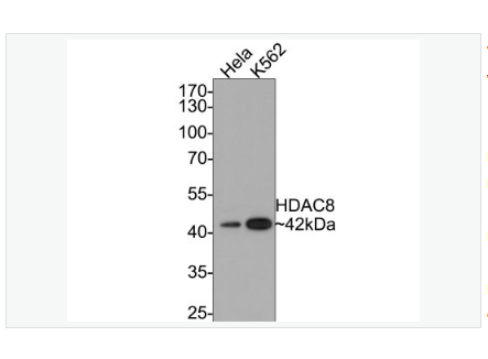 Anti-HDAC8 antibody -组蛋白去乙酰化酶8重组兔单克隆抗体