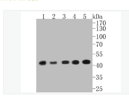 Anti-alpha smooth muscle Actin antibody-α-SMA重组兔单克隆抗体