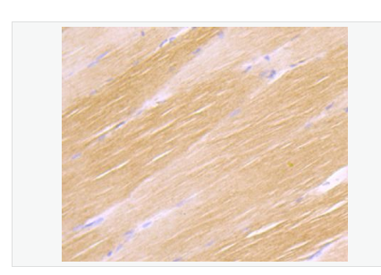 Anti-H Cadherin antibody-心脏钙粘蛋白重组兔单克隆抗体