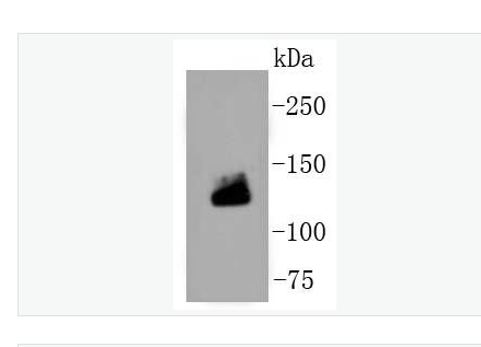 Anti-Collagen I antibody-I型胶原重组兔单克隆抗体