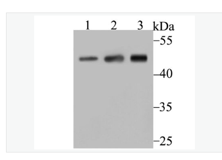 Anti-ARP3 antibody-细胞骨架肌动蛋白样蛋白3抗体