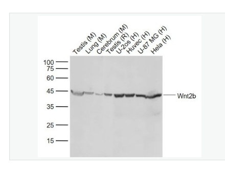 Anti-Wnt2b antibody-信号通路Wnt2B重组兔单克隆抗体